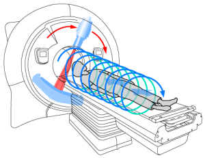 cпиральная компьютерная томография