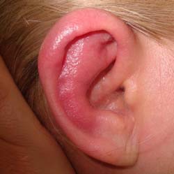 Заболевание ушей у детей